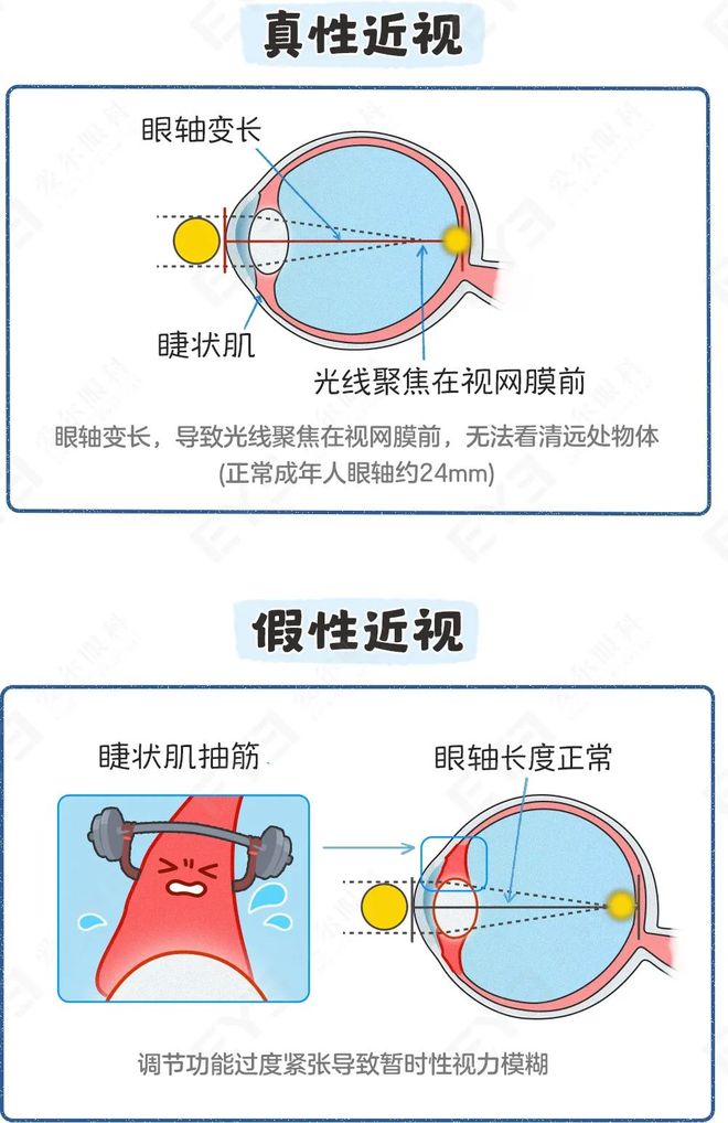 孩子近视50度，要马上配眼镜吗？